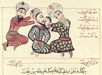 Ms Sup Turc 693 fol.76v Escissione di una Ranula sotto la Lingua da Charaf ed Din